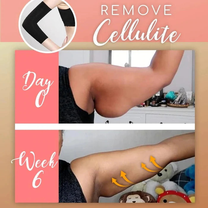 1+1 GRATIS | ToneUp™ – Armformende Ärmel für straffere und geformte Arme!