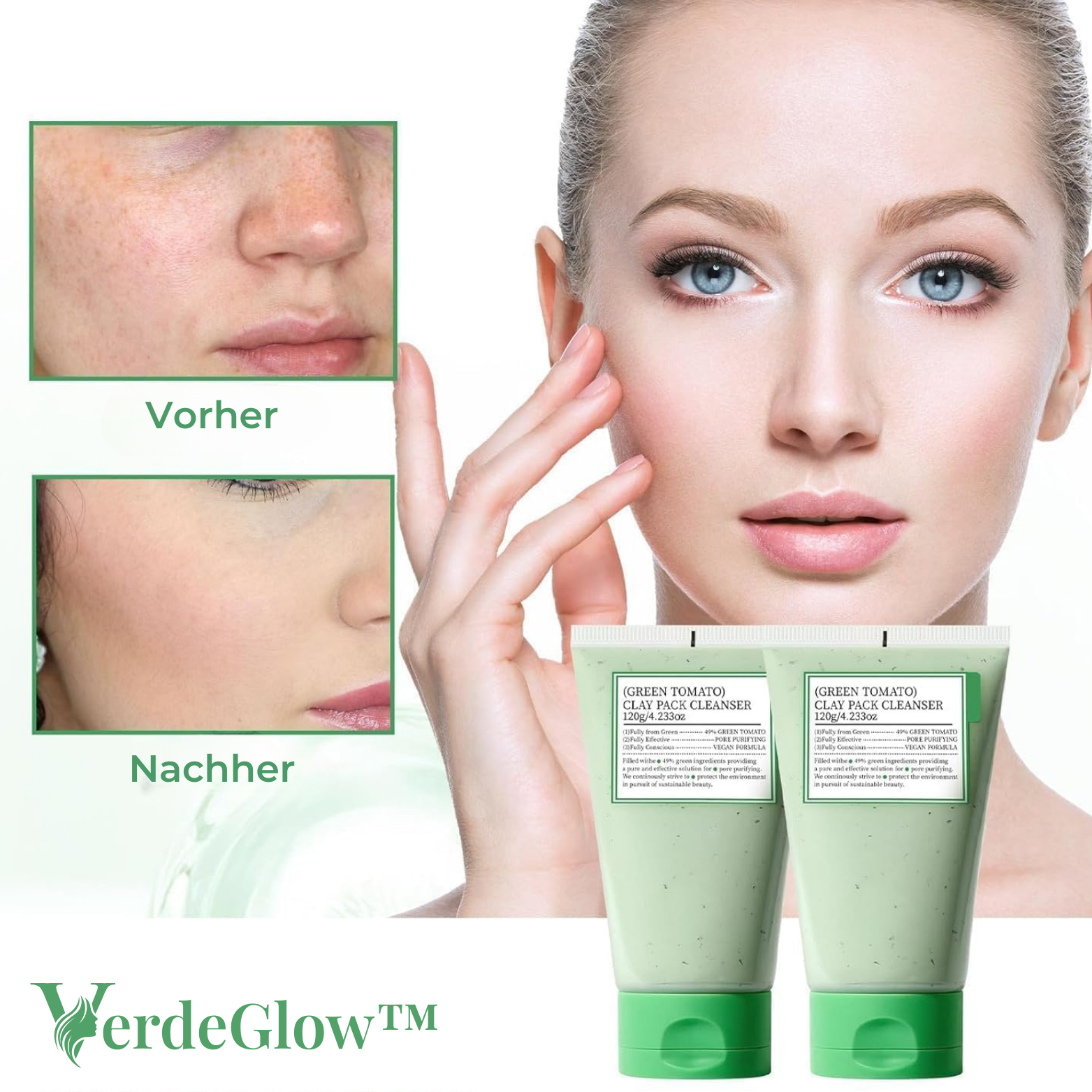 1+1 GRATIS | VerdeGlow™ Grünes Tomaten Tonerde Maske – Tiefenreinigung und Anti-Akne
