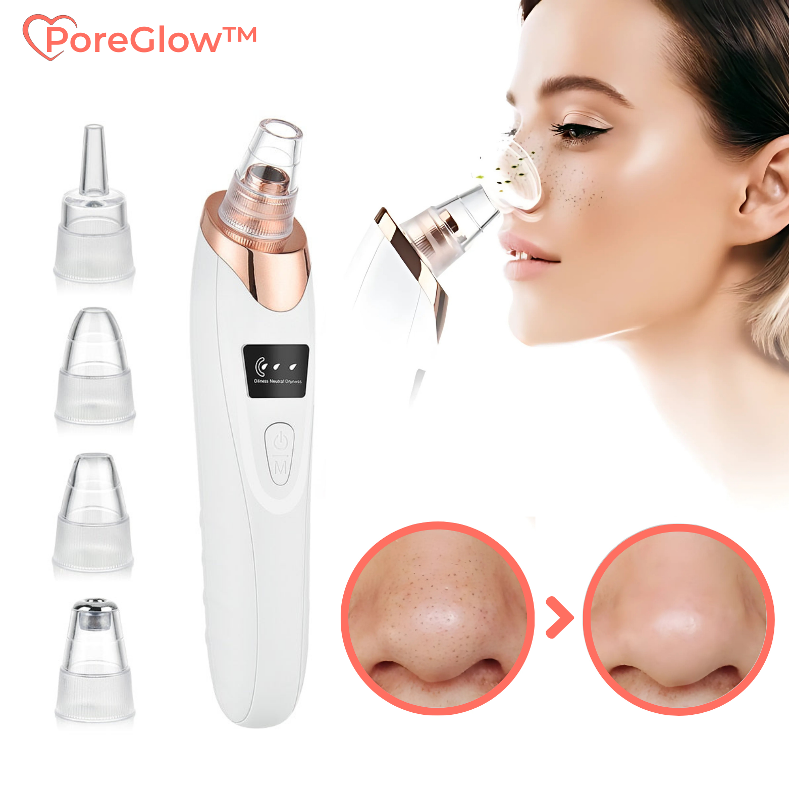 PoreGlow™ Mitesser Entferner Set