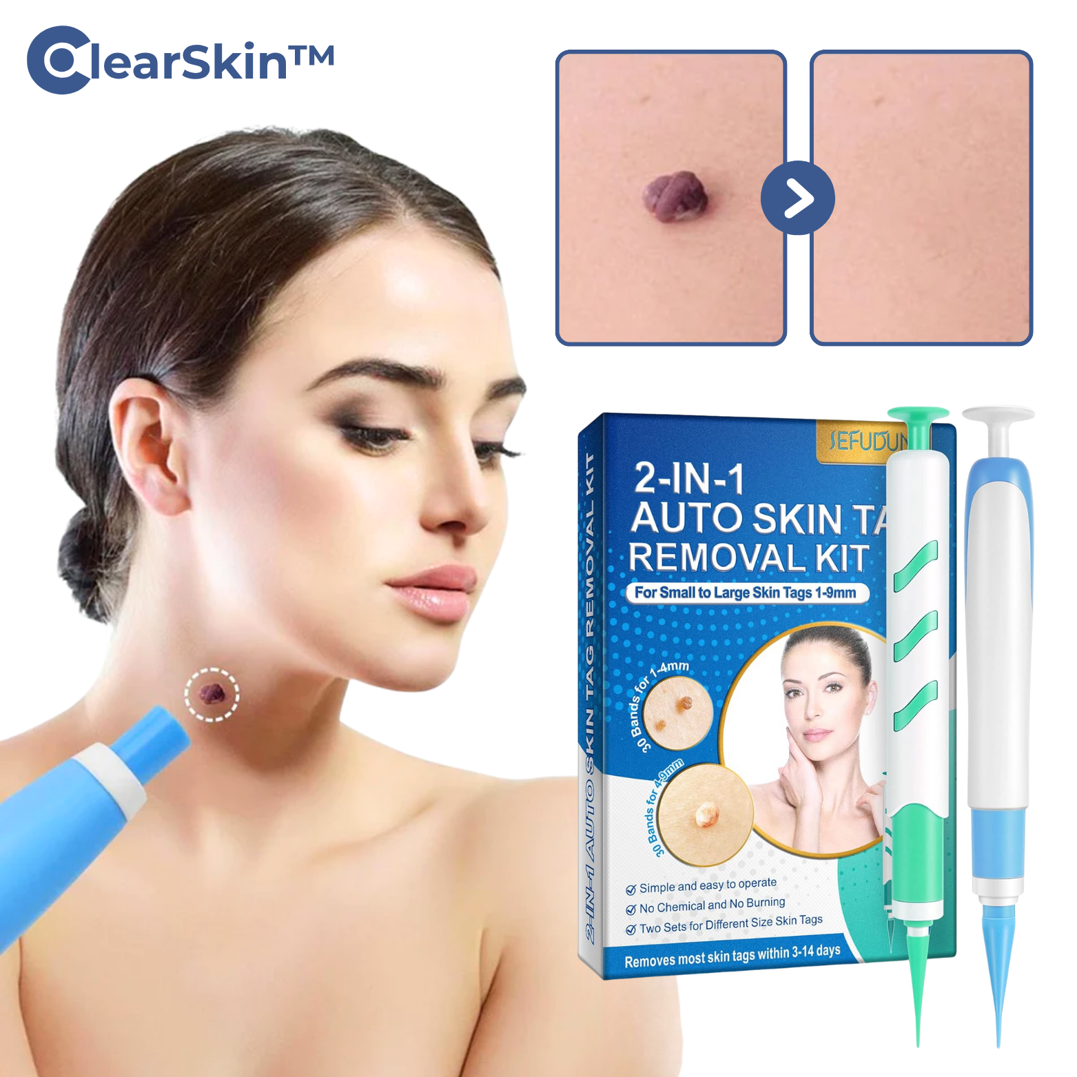 ClearSkin™ Warzenentferner Stift
