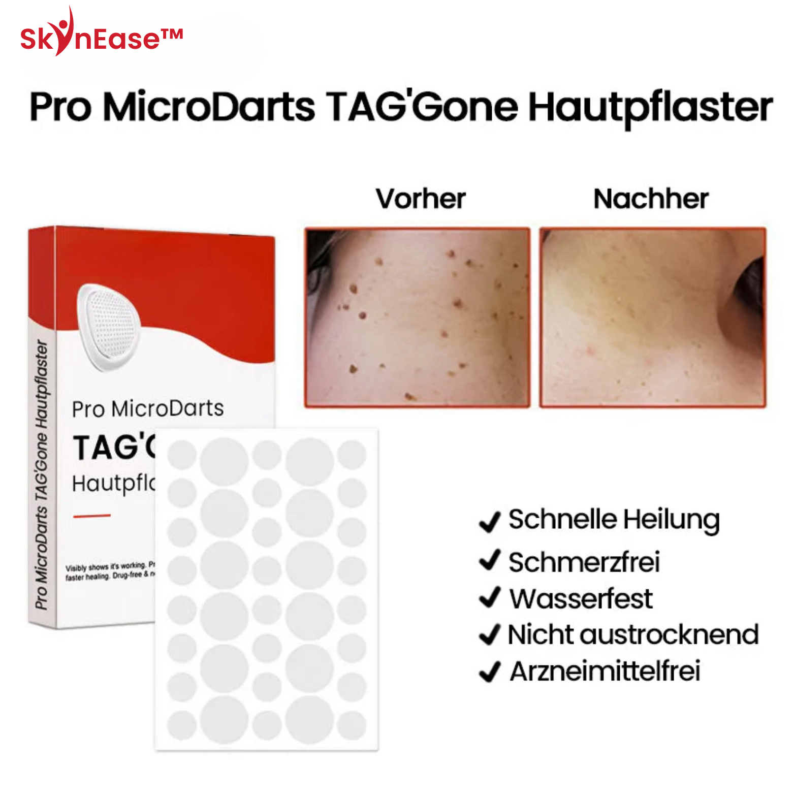 SkinEase™ Microdarts Anti-Falten Patch
