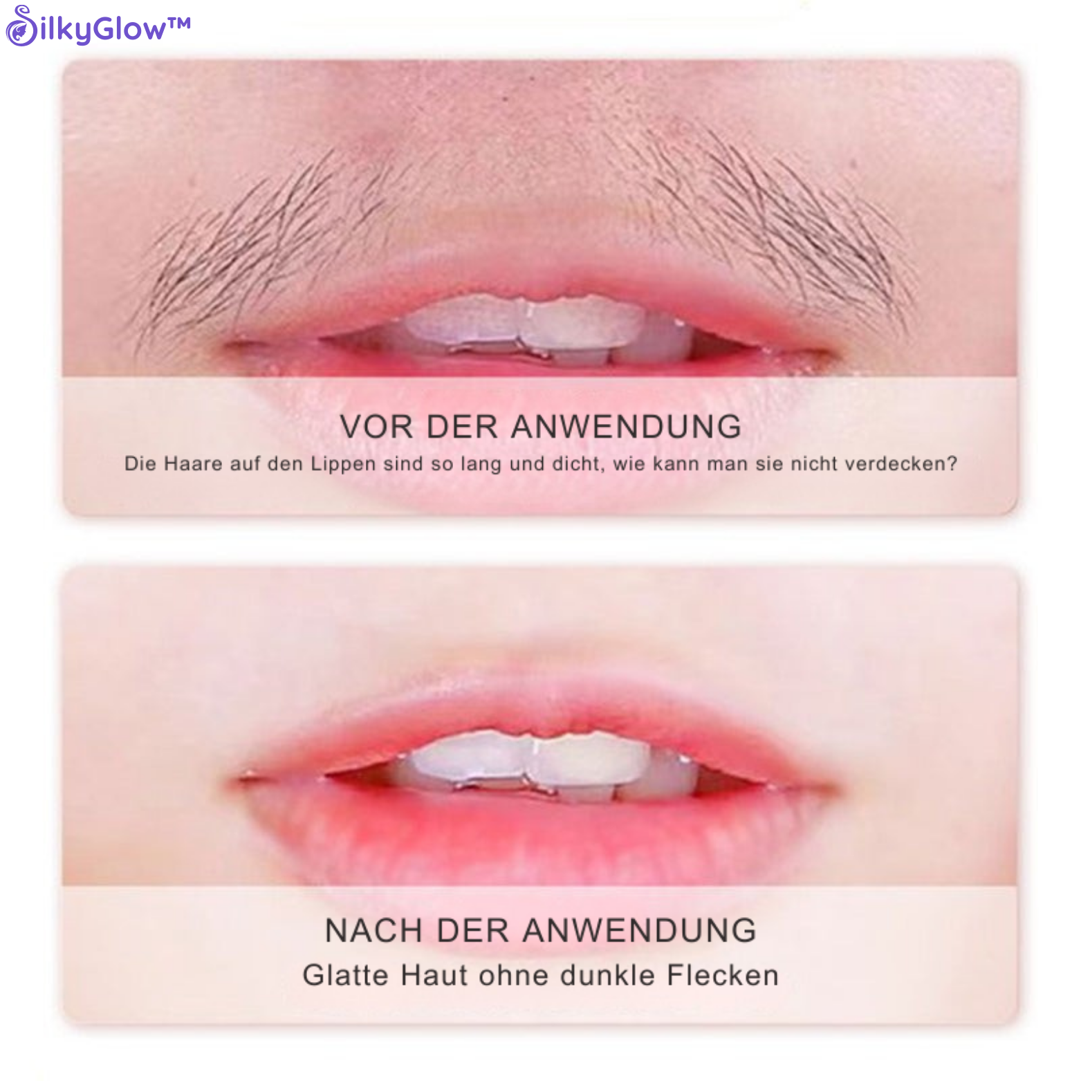 1+1 GRATIS | SilkyGlow™ Gesichts-Haarentfernungscreme