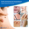 ClearSkin™ Warzenentferner Stift