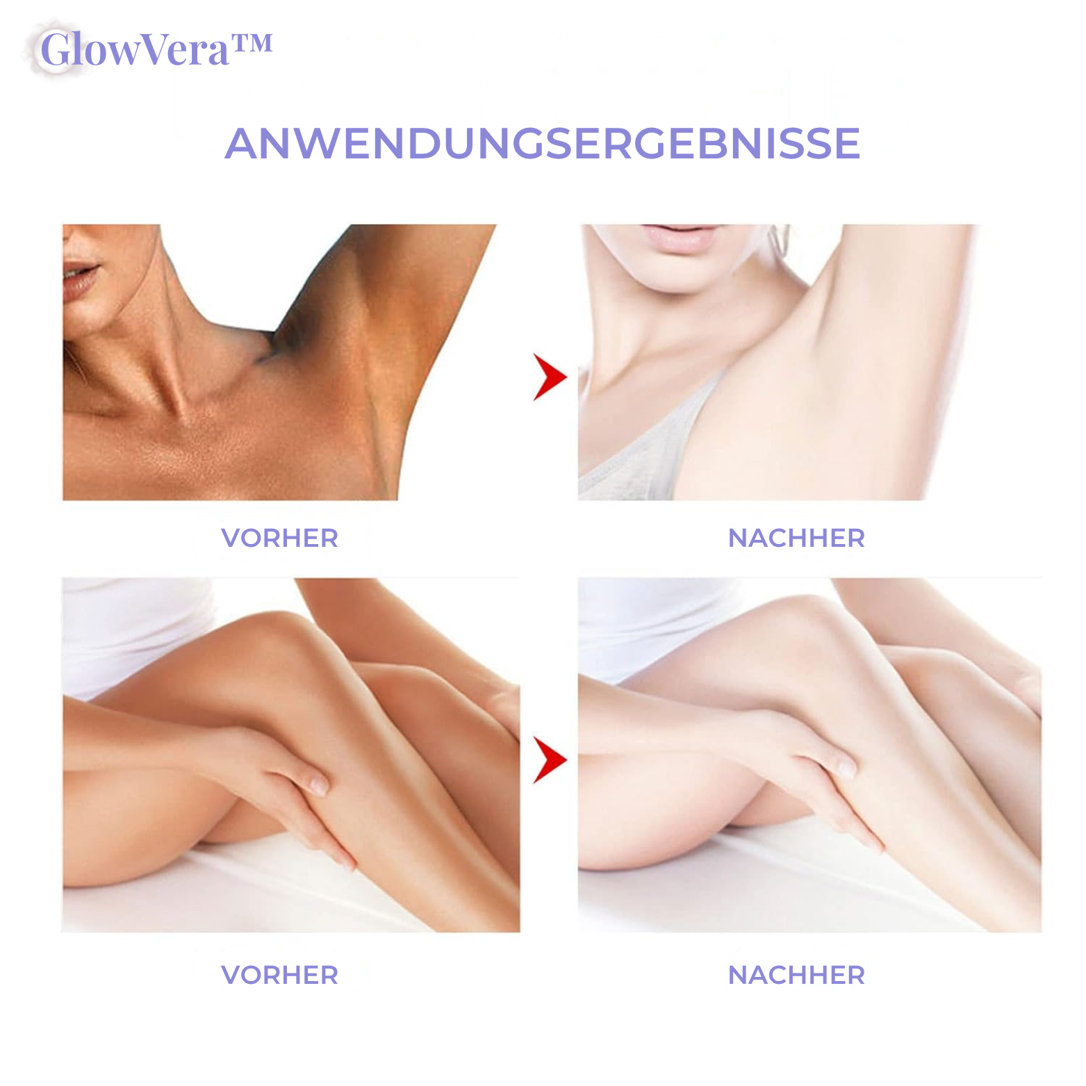 GlowVera™ Aufhellende Körpercreme
