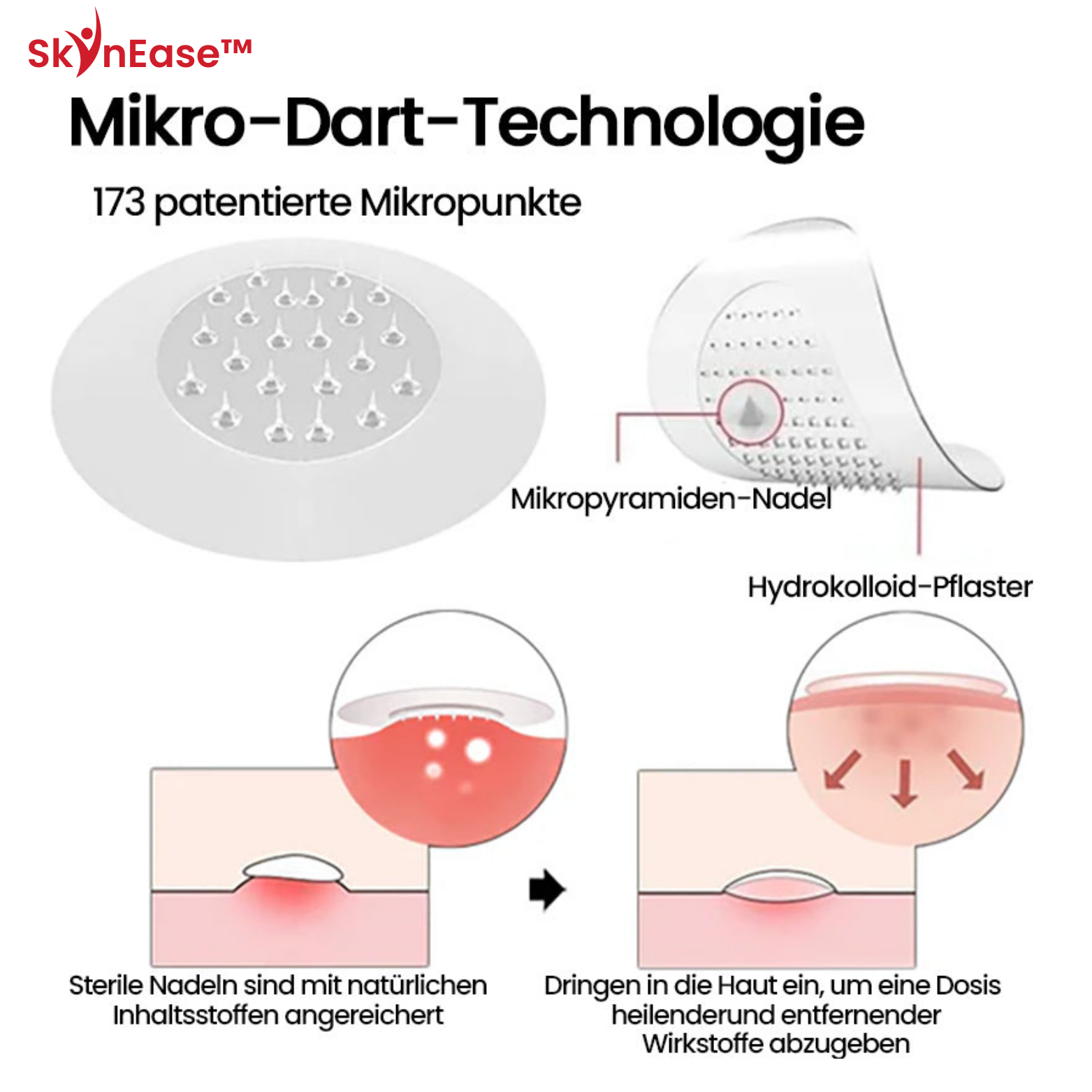 SkinEase™ Microdarts Anti-Falten Patch