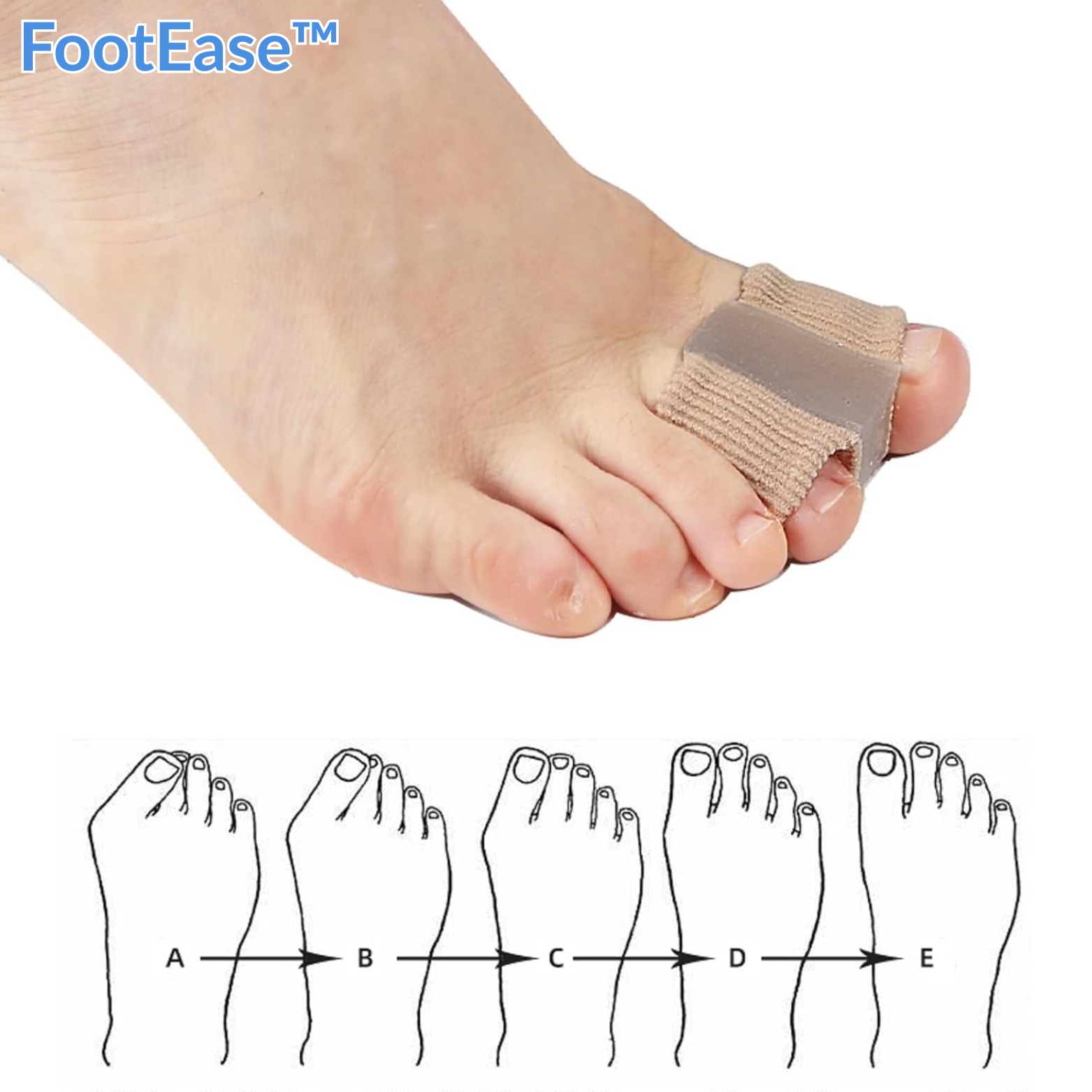 1+1 GRATIS | FootEase™ Zehentrenner und Hallux Valgus Korrektor