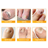 1+1 Gratis | Nalix™ - Wirksame Behandlung von Nagelpilz