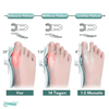 ZehenFit™ Hallux Valgus Korrektur & Zehenspreizer