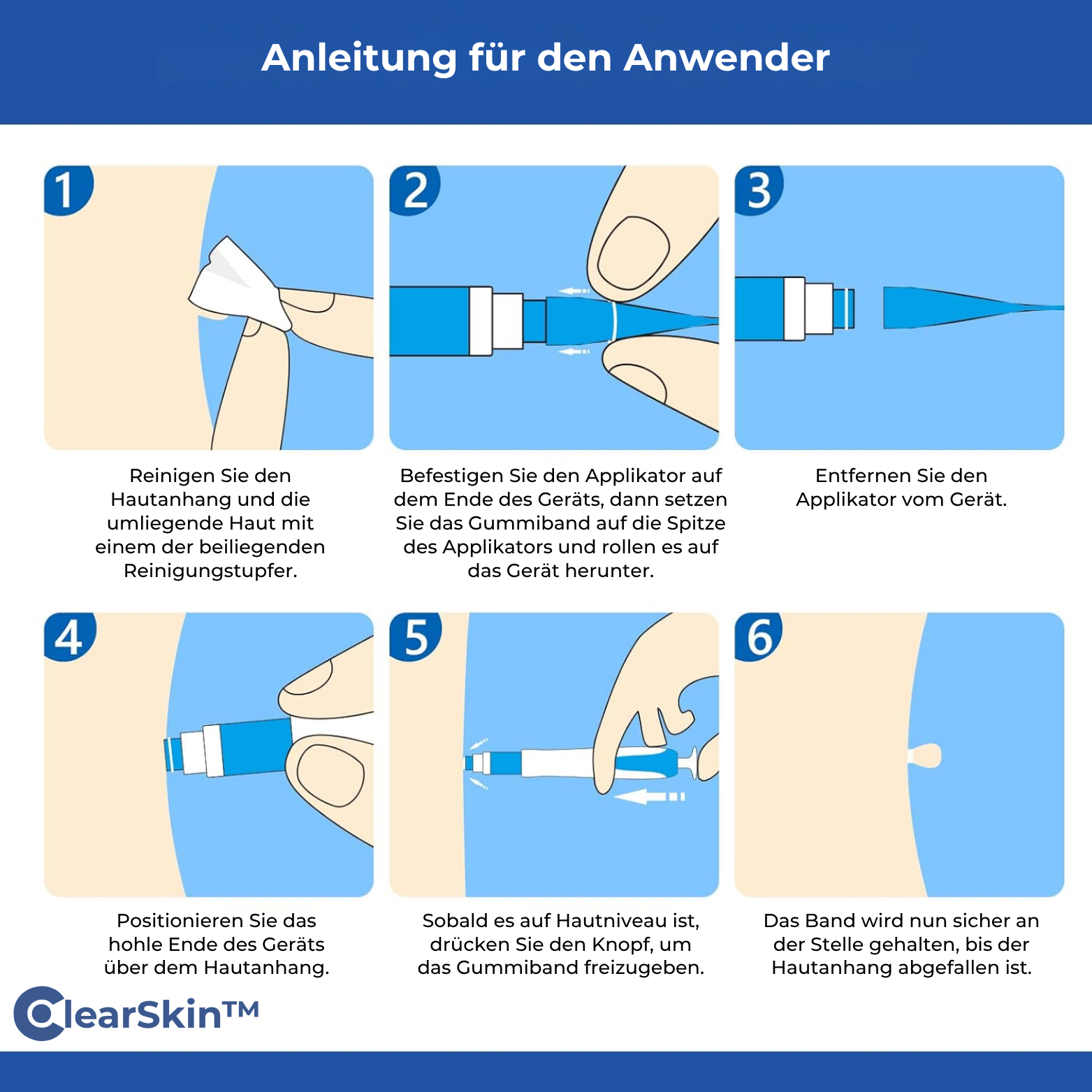 ClearSkin™ Warzenentferner Stift