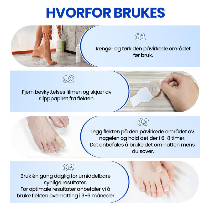 1+1 Gratis | Nalix™ - Wirksame Behandlung von Nagelpilz