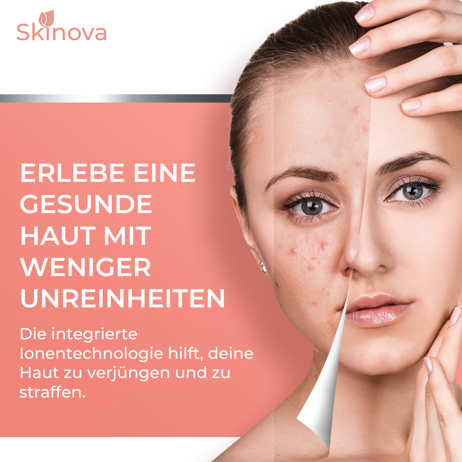 Skinova Ultraschall Gesichtsreiniger