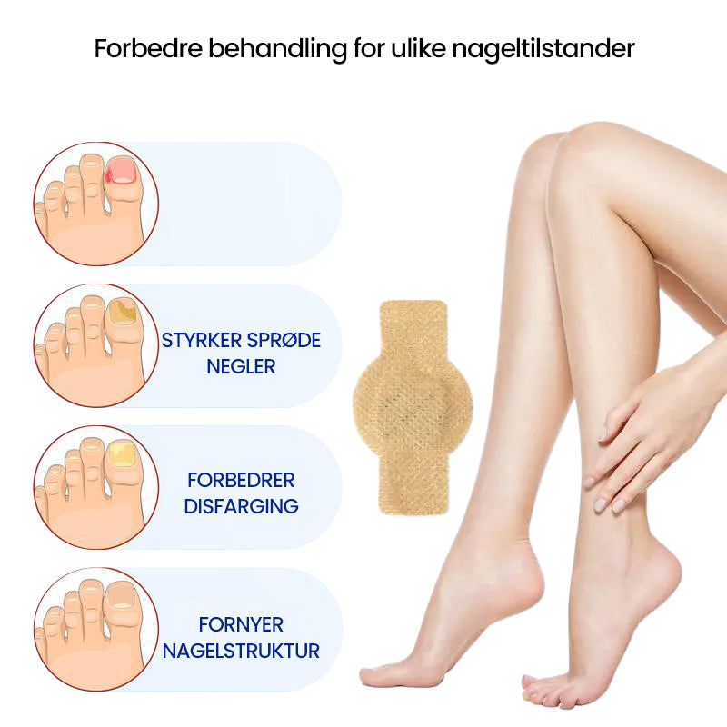 1+1 Gratis | Nalix™ - Wirksame Behandlung von Nagelpilz