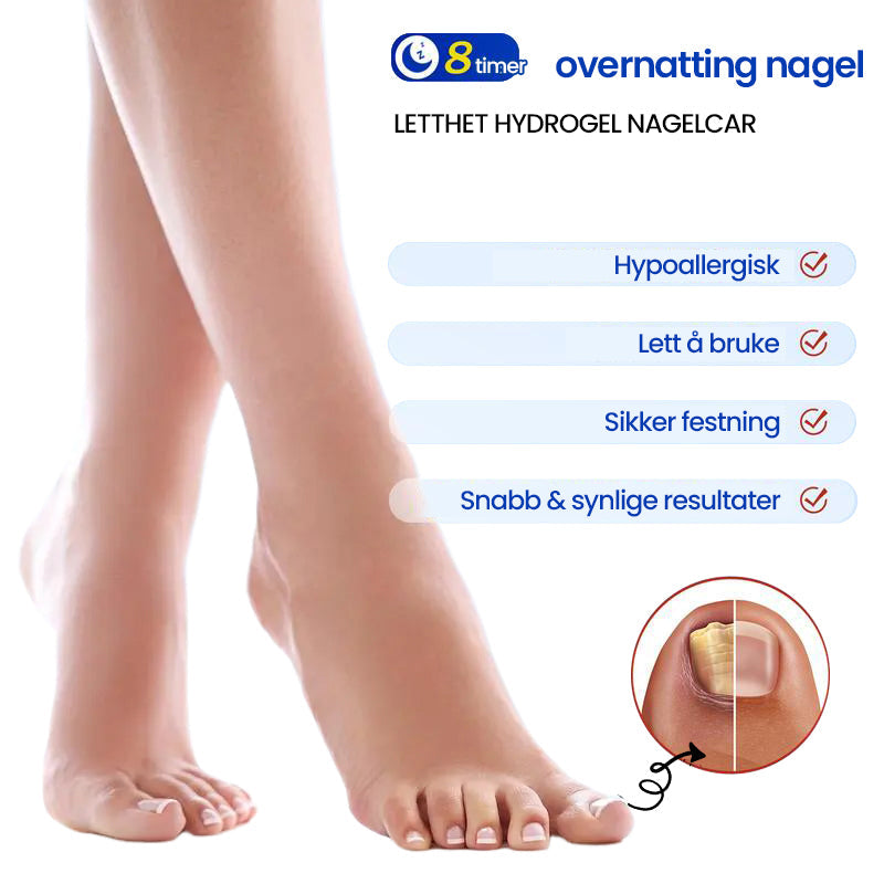 1+1 Gratis | Nalix™ - Wirksame Behandlung von Nagelpilz