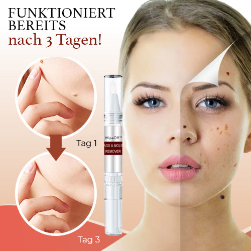 1+1 GRATIS | WiCla™ Tags und Maulwurfsentferner