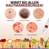 1+1 GRATIS | WiCla™ Tags und Maulwurfsentferner
