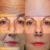 ActiSkin™ Linienauffrischung 24K Gold Serum