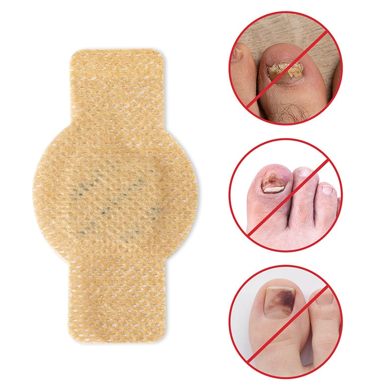 1+1 Gratis | Nalix™ - Wirksame Behandlung von Nagelpilz