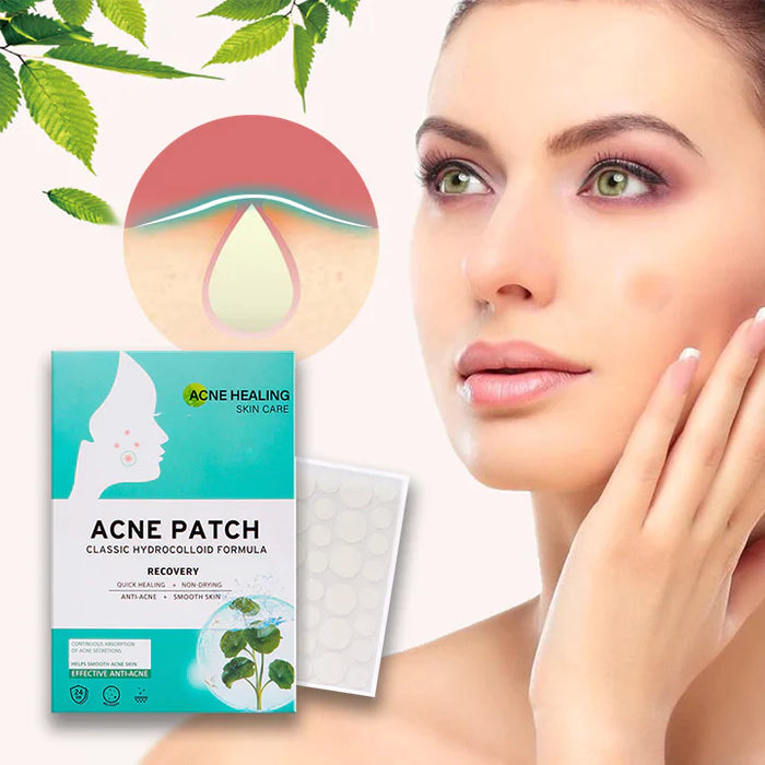 AcNatch™ - Pflaster zur Entfernung von Akne und Hautmarkierungen